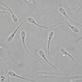 animal's semen