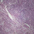 uterine tissue