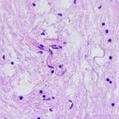 brain tissue