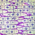 onion root tip